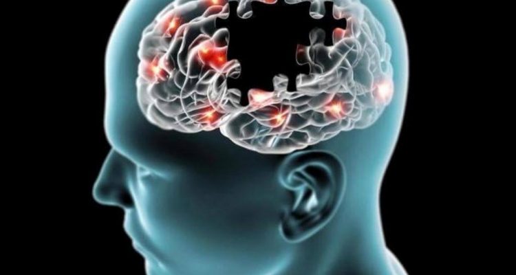 Demencija: netolimoje ateityje gali būti rastas vaistas nuo jos – atradimas