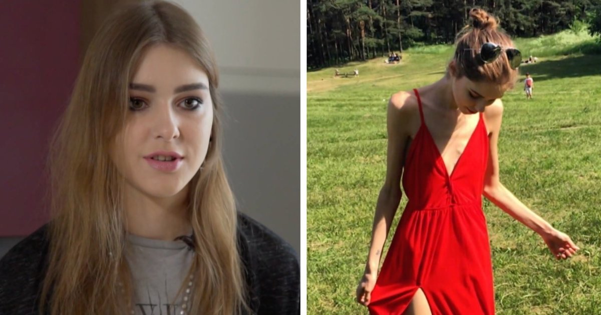 Skeletas, aptrauktas plona oda – Paula Čepinskaitė prabilo apie pavojingą ligą: galėjau mirti