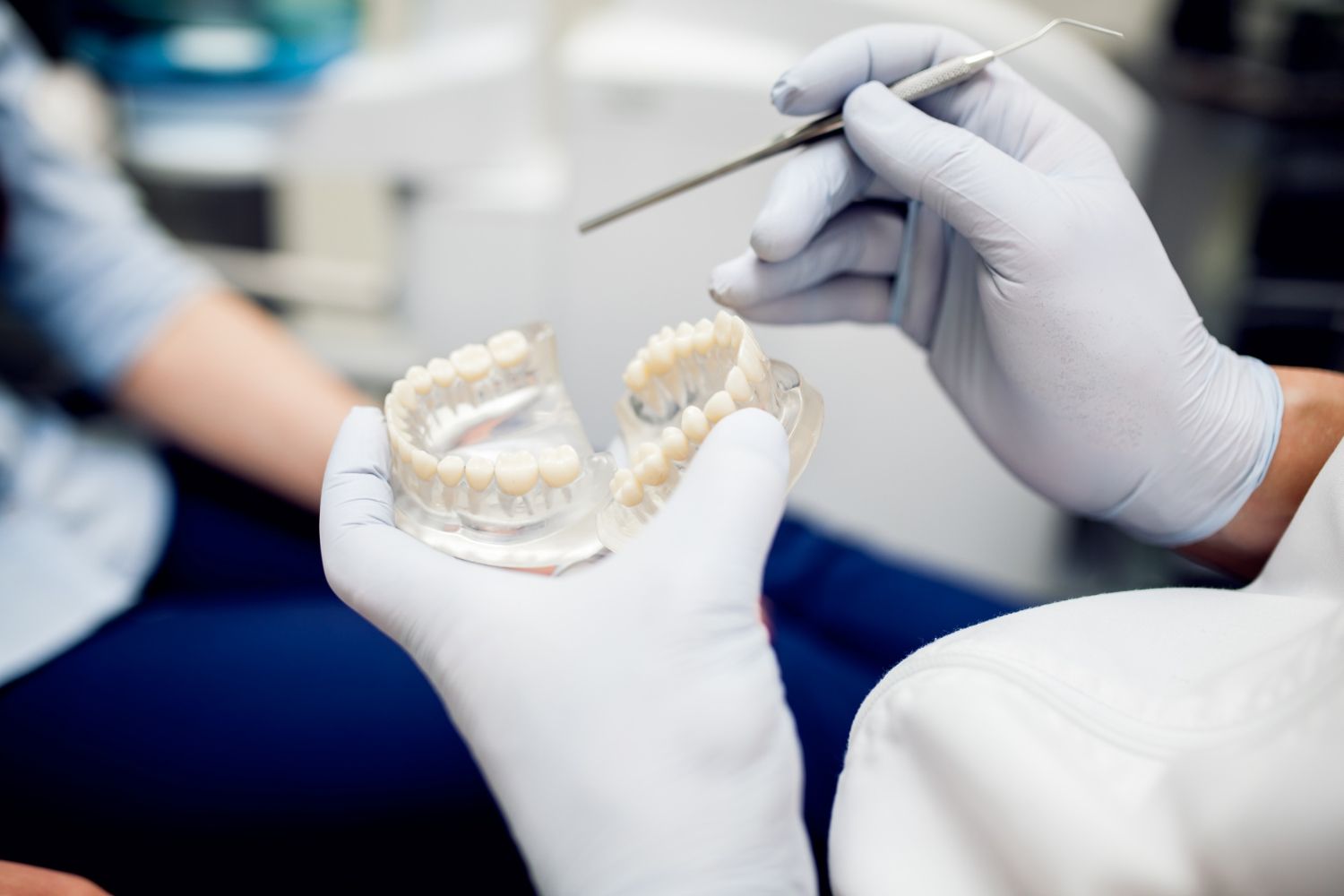 Dantų implantai: 8 dažniausi mitai ir tiesa, kurią svarbu žinoti prieš priimant sprendimą