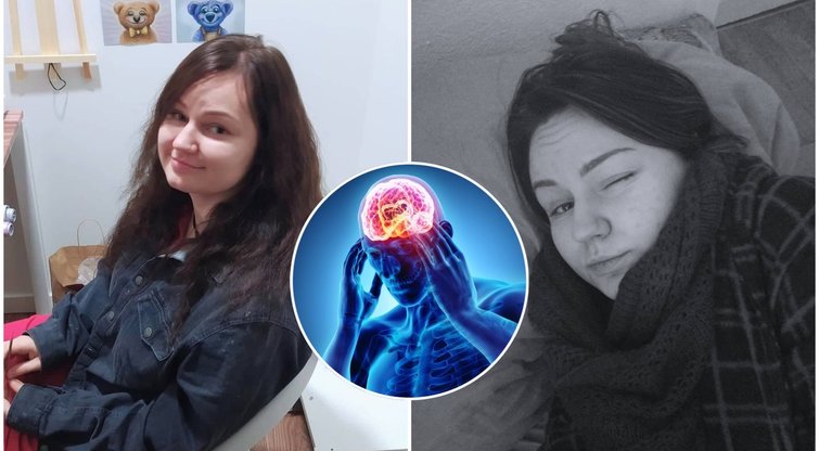 Įkyrus galvos skausmas radviliškietei pranašavo skaudžią ligą: įspėja kitus nenumoti ranka
