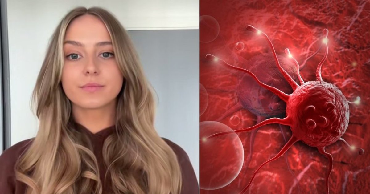Jaunai merginai kraujo vėžys pasireiškė vos 1 simptomu: nesuprato net medikai