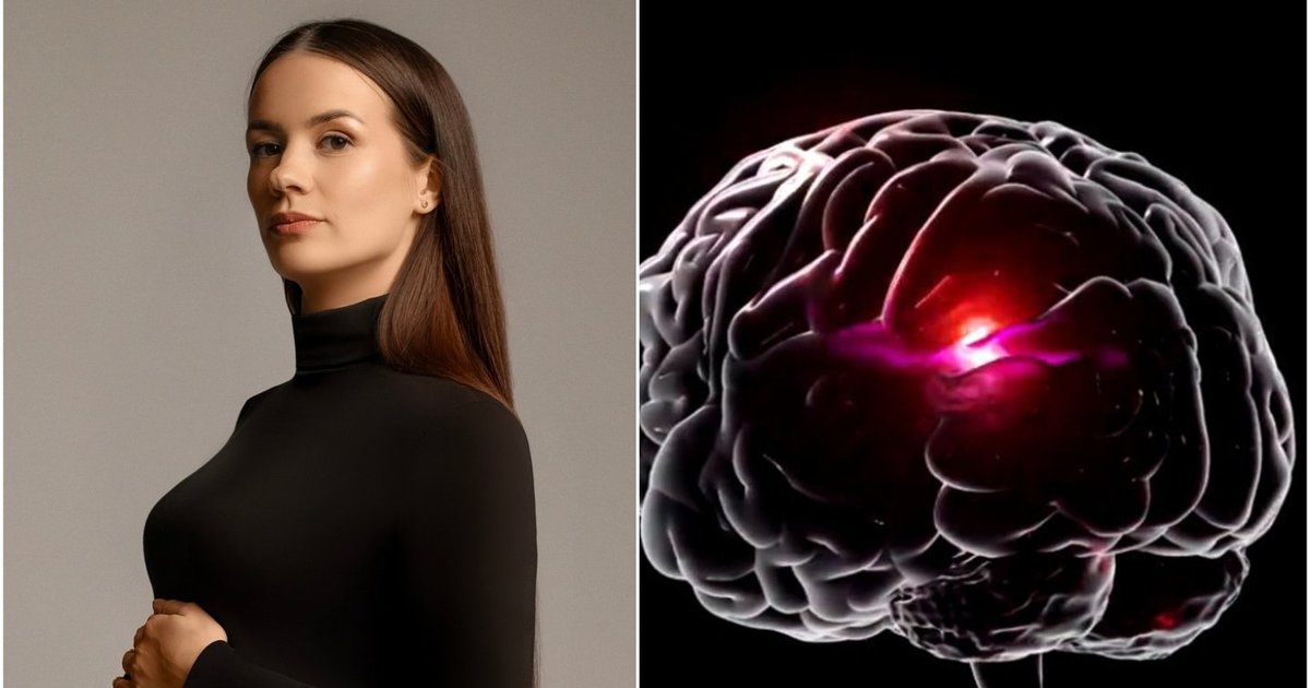 30-metei Agnei vos per kelias valandas paralyžiavo pusę kūno: gydytojai galvoje aptiko netikėtą darinį