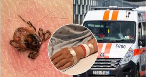 Ragina pasisodinti šį augalą sode: erkių neliks nė kvapo
