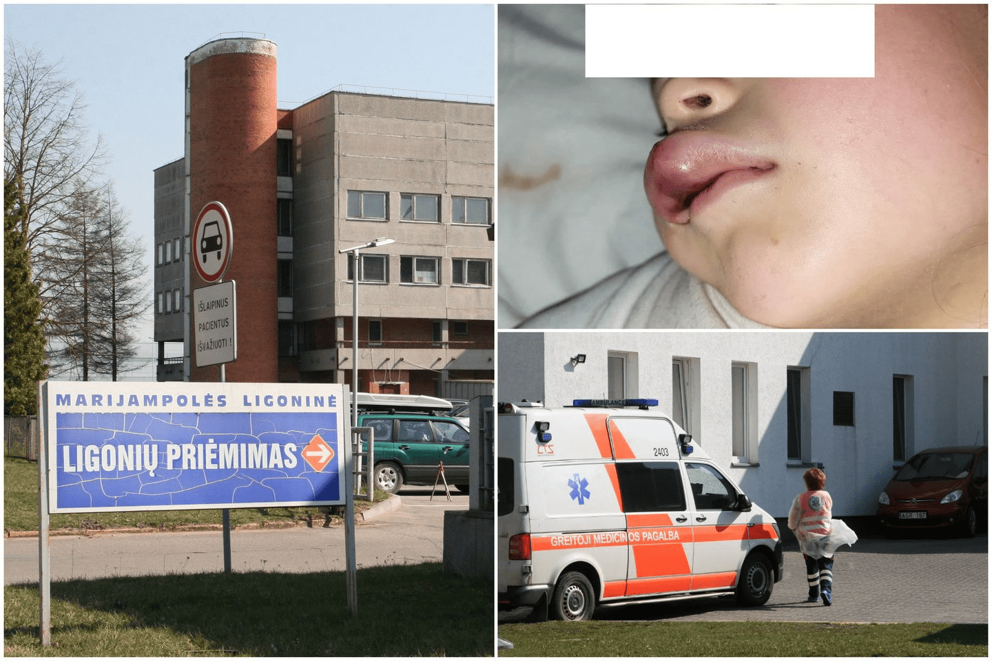 Net medikai pakraupo pamatę, kaip sužalotą vaiką kolegos išleido namo: šešiametei galėjo grėsti mirtinas pavojus. Ligoninė kaltinimus neigia