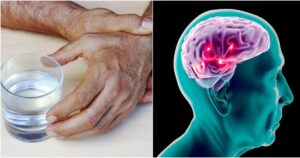 Legendinis aktorius atsivėrė apie Parkinsono ligos diagnozę: „Tapo sunkiau...“