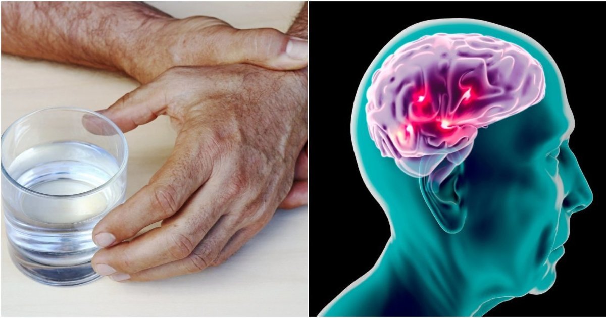 Legendinis aktorius atsivėrė apie Parkinsono ligos diagnozę: „Tapo sunkiau...“